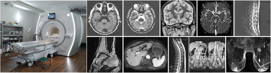 MRI